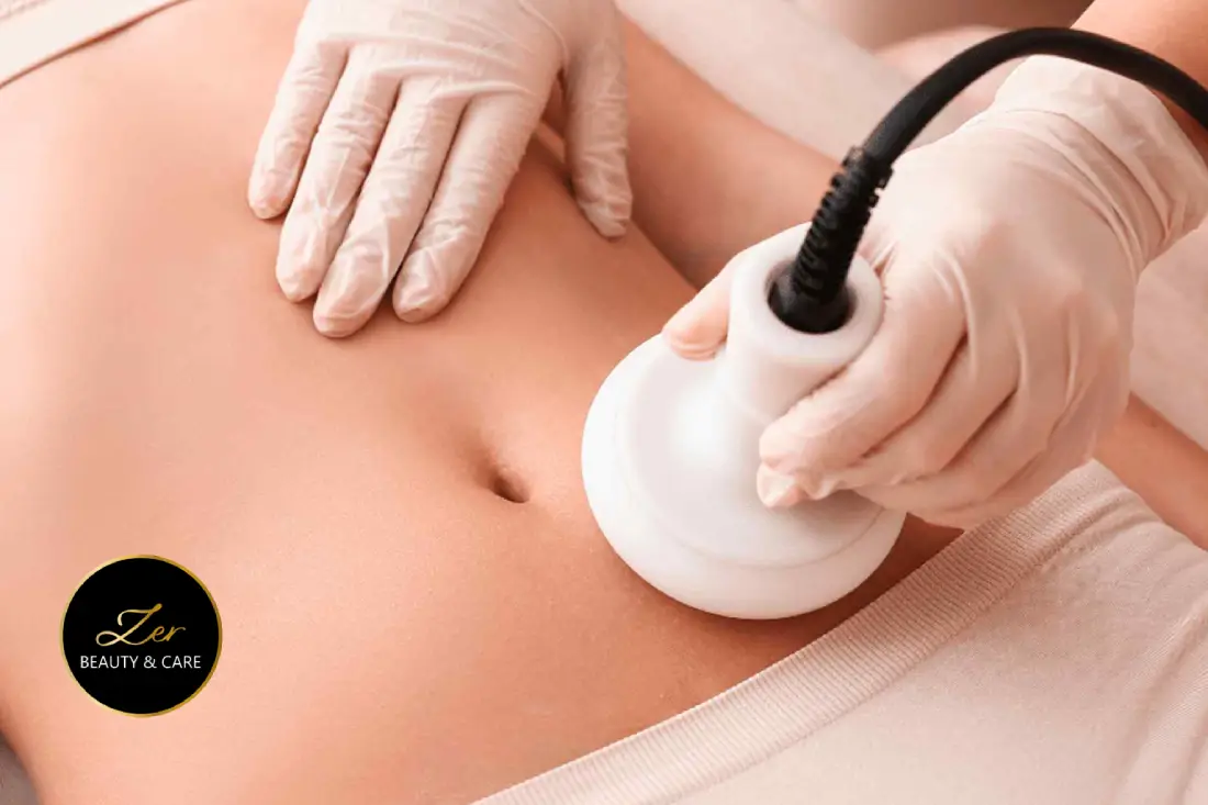 Körfez bölgesel incelme uygulaması karın bölgesi sıkılaştırma ve inceltme cihazı işlemi Zer Beauty Körfez güzellik merkezi